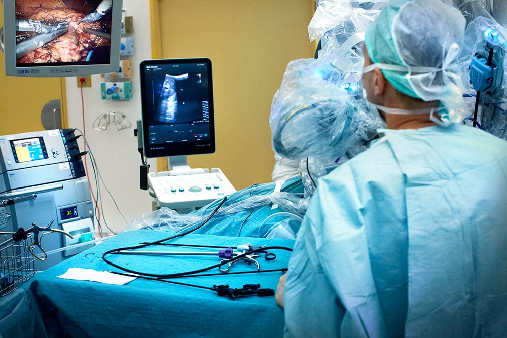 The Benefits of Ultrasound in Robotic Surgery